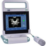MDPro MD5 Bladder Scanner - Dental & Medical Equipment Supplier