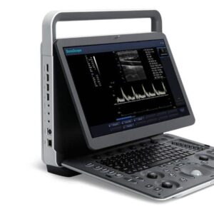Sonoscape E1 Portable Ultrasound